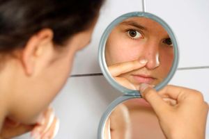 Hormonal imbalances can lead to acne in teens